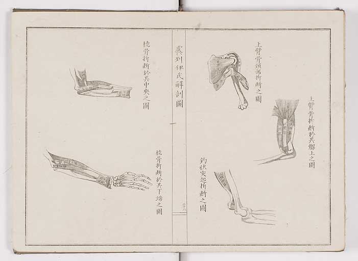 K0036s0041