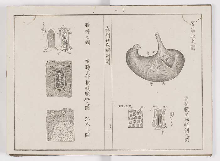 K0036s0056