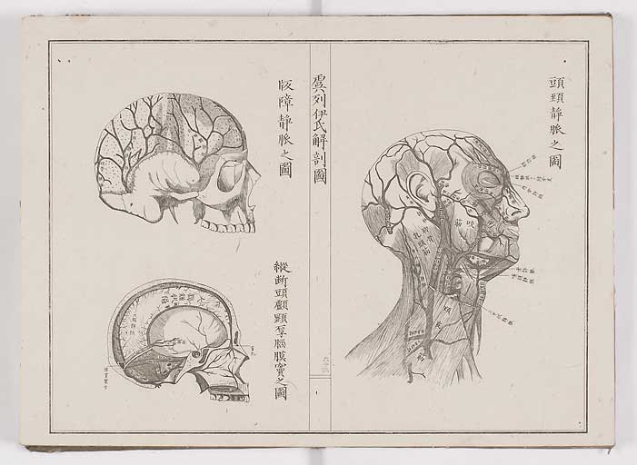 K0036s0070