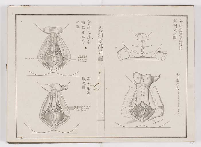 K0036s0083