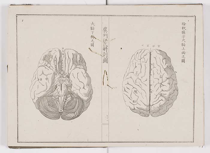 K0036s0085