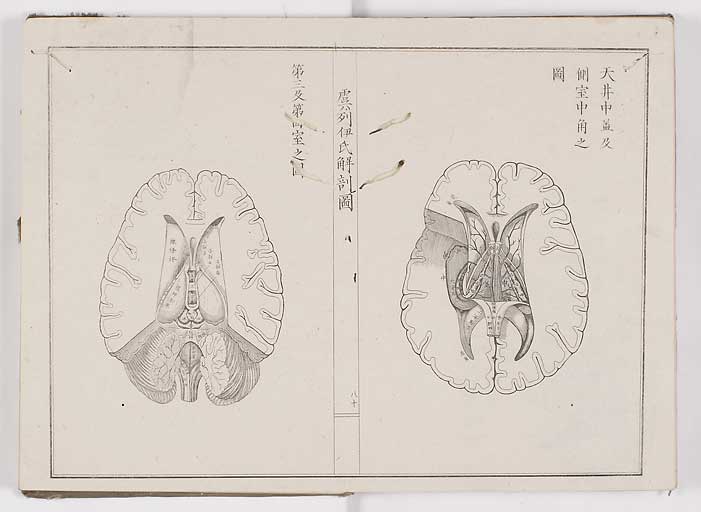 K0036s0087