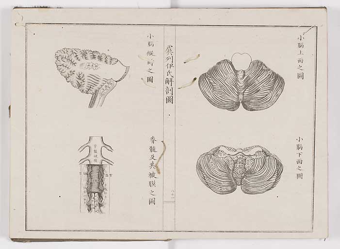 K0036s0088
