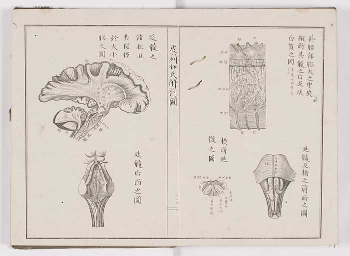 K0036s0090