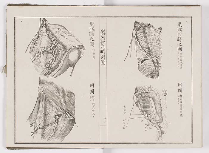 K0036s0105