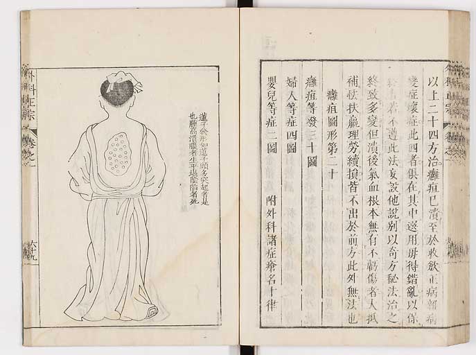 K0041s0094