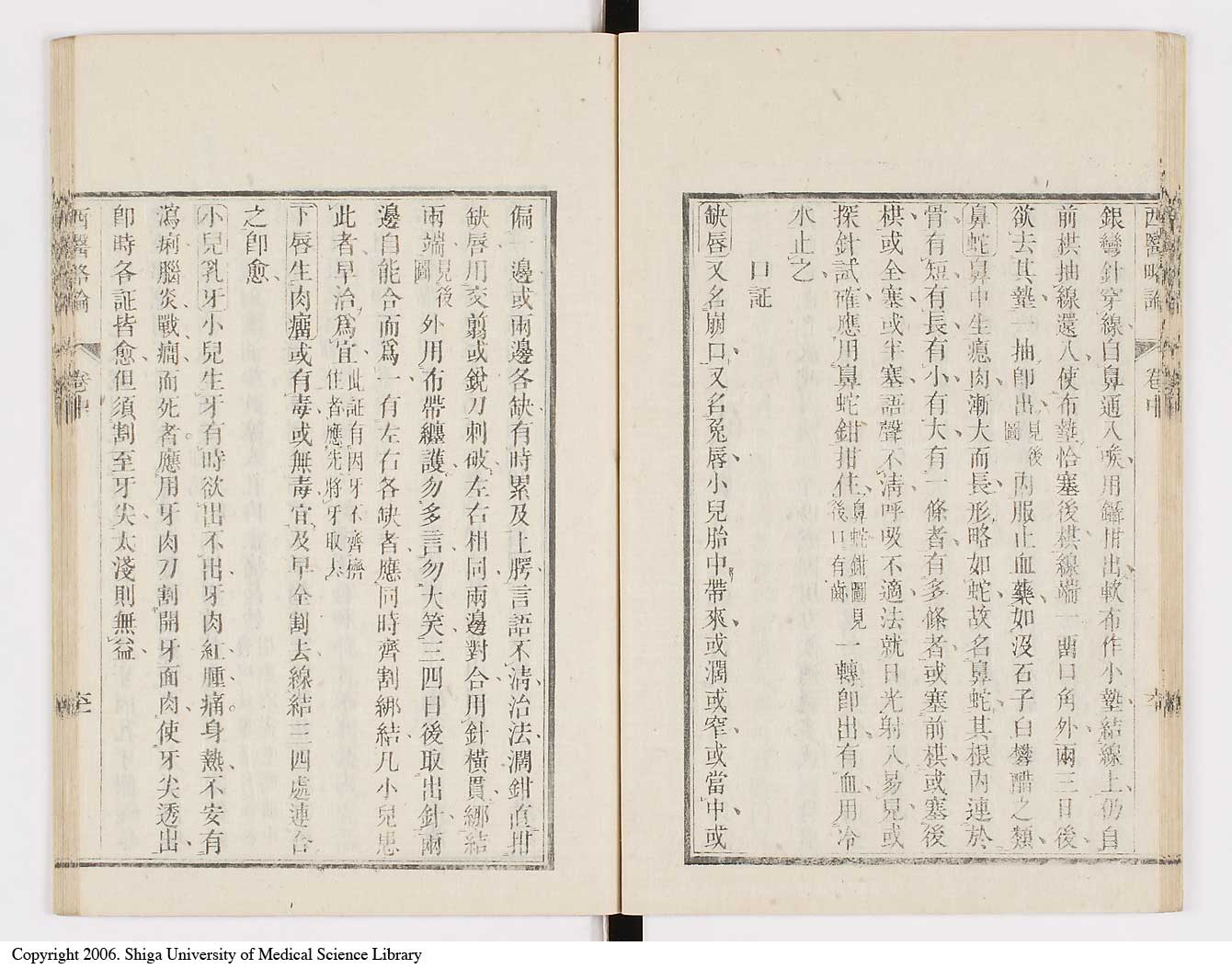 K0079l0142