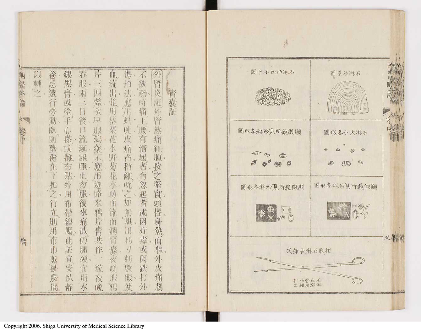 K0079l0166