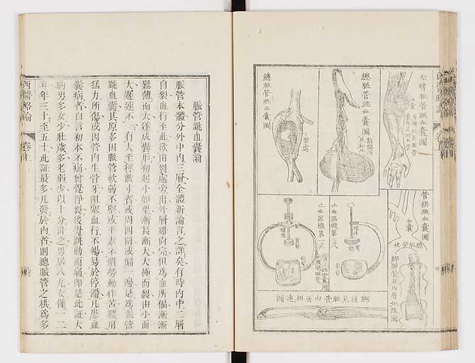 K0079s0046