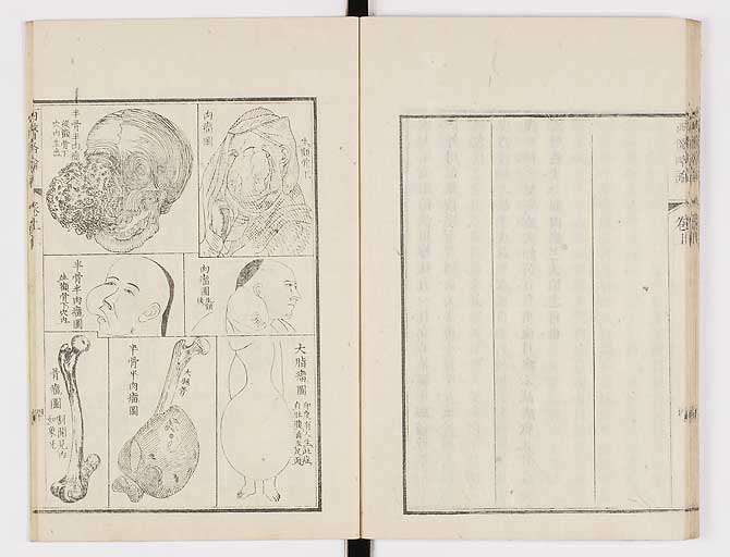 K0079s0055