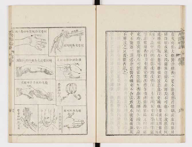 K0079s0090