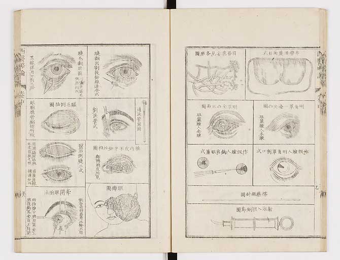 K0079s0139