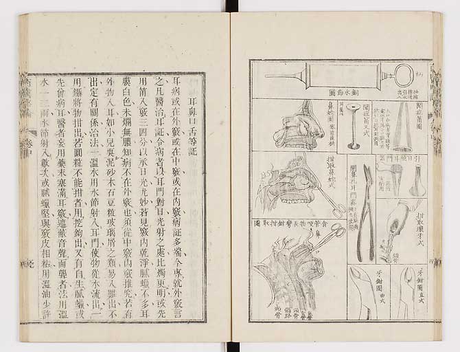 K0079s0140