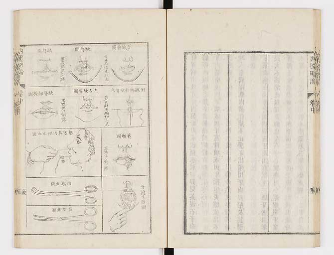 K0079s0145