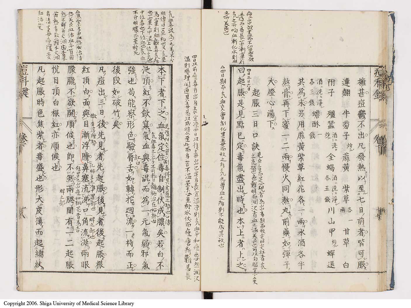K0094l0152