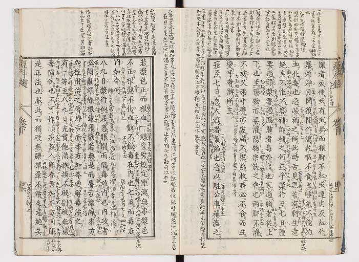 K0094s0160