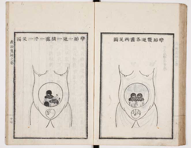 S0033s0060