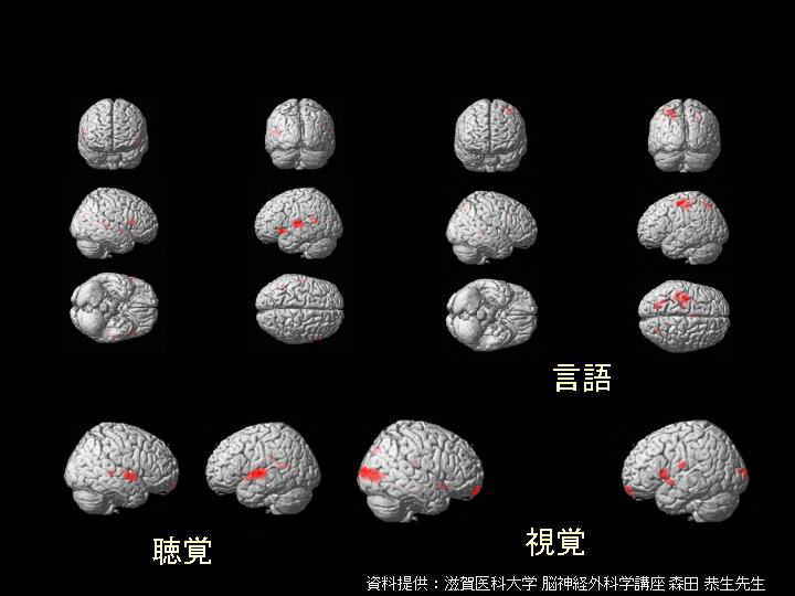 FMRI