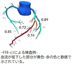 写真：マッピング・Carto･navxシステム