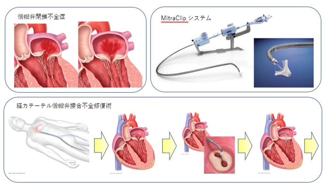 腫瘍循環器）