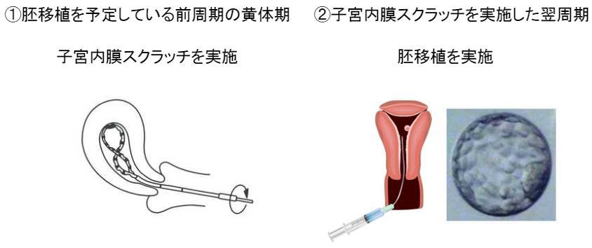 サンプル