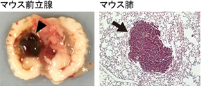 Epithelial membrane protein 1は、copine-III、Rac1を介して細胞運動を亢進させ、がんの転移を促進する