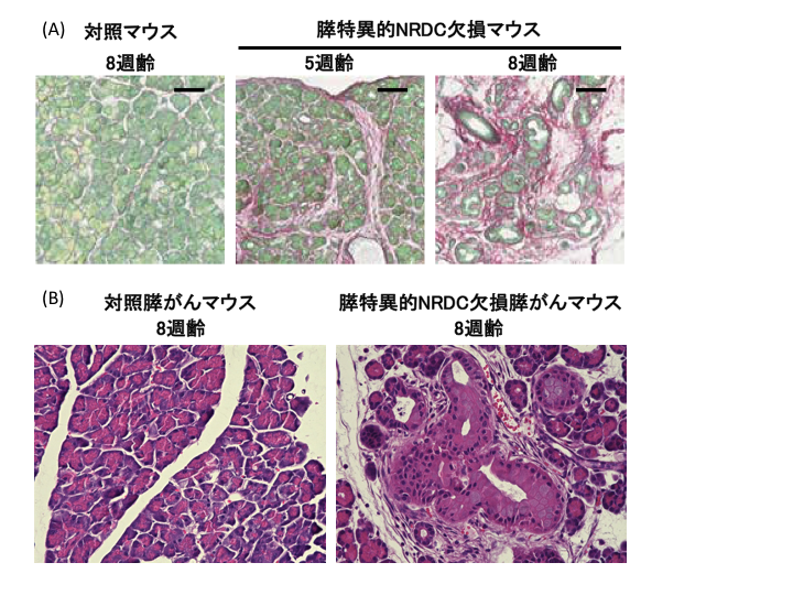 慢性膵炎、膵がん発症を制御する新たなメカニズムの解明