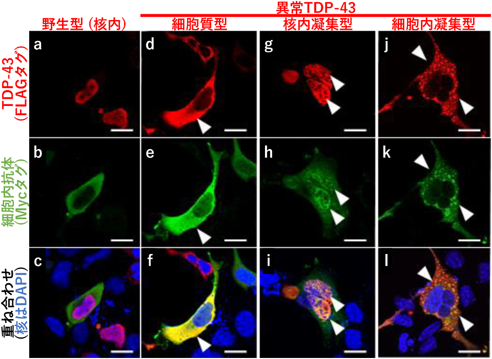 図  二つのタンパク質分解経路への指向性を有する細胞内抗体を用いた、筋萎縮性側索硬化症(ALS) 関連蛋白質TDP-43凝集体の除去