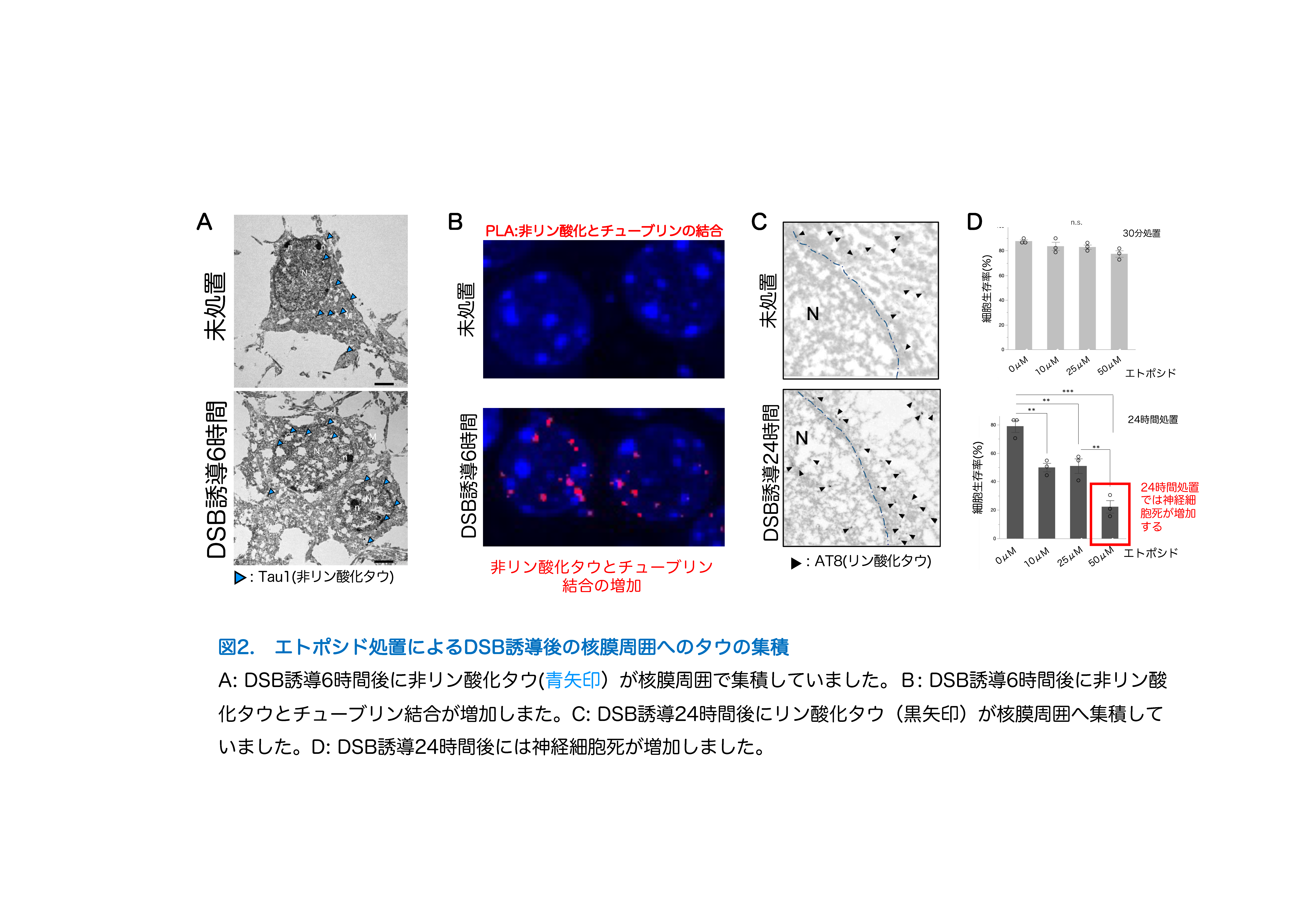 最新研究の紹介】タウによる二本鎖DNA損傷修復不全はin vitroで