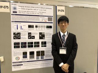 医学部医学科第4学年(研究医養成コース)の福永諒氏 写真:医学部医学科第4学年(研究医養成コース)の福永諒氏
